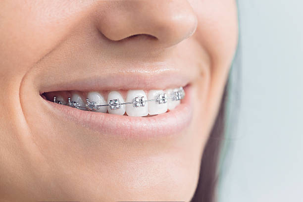Dental Inlays and Onlays in Pascagoula, MS